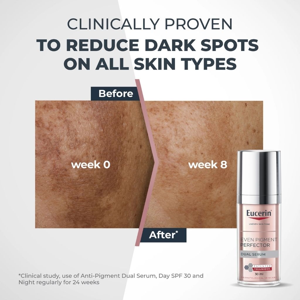Eucerin Anti-Pigment Dual Serum Dark Spots 30ml