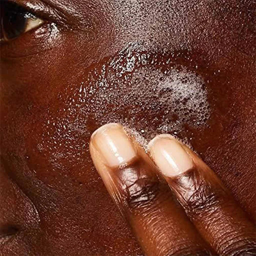 CeraVe Blemish Control Cleanser For Blemish‑Prone Skin 236 ml