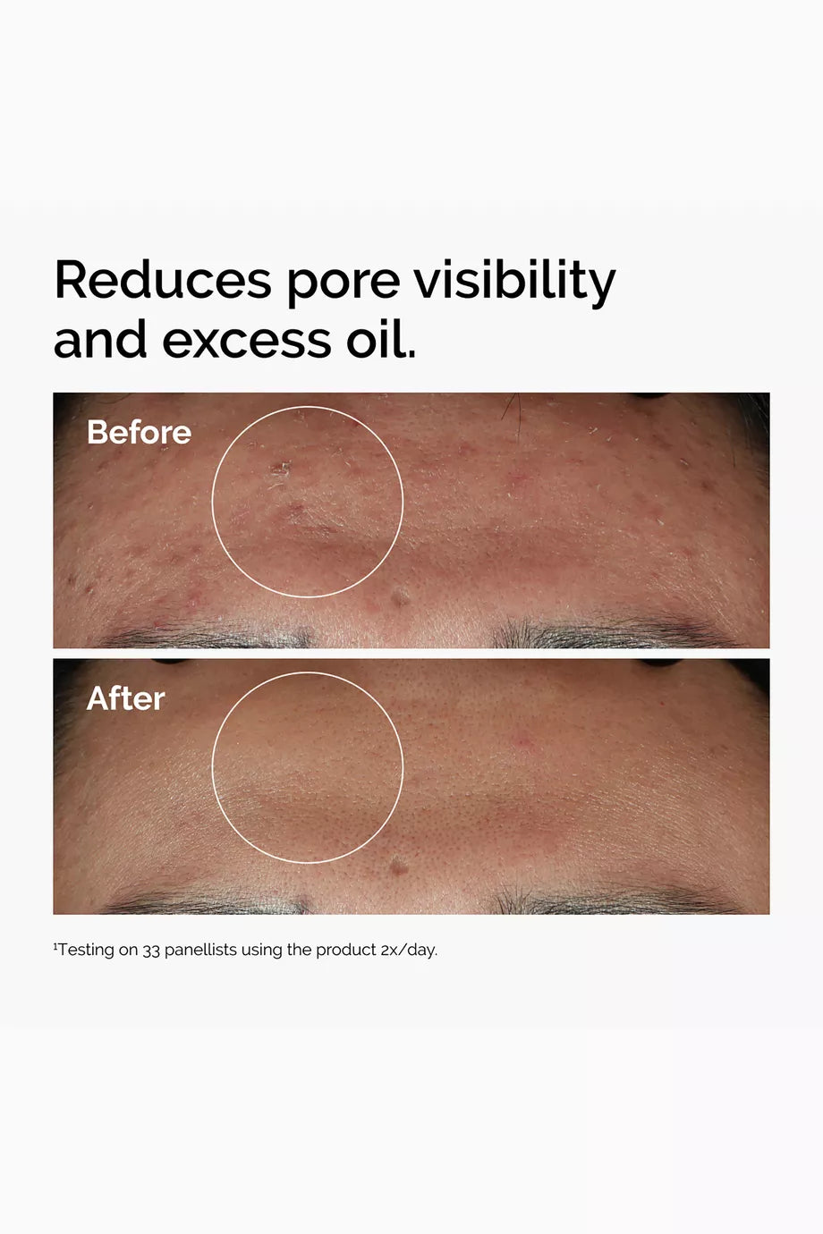 The Ordinary Niacinamide 10% + Zinc 1% Serum 30ml