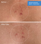 Murad Retexturizing Body Pads – 45 Pads