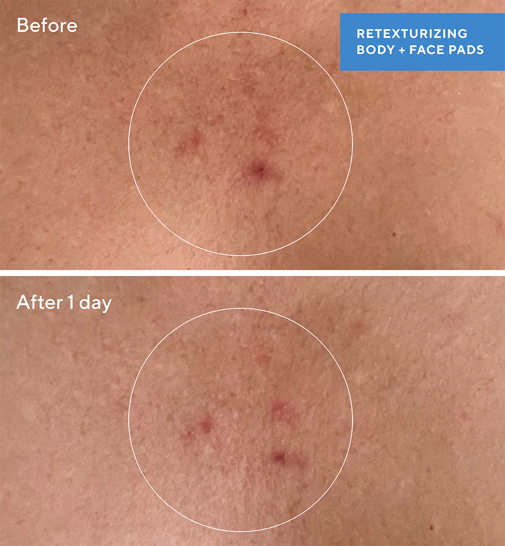 Murad Retexturizing Body Pads – 45 Pads
