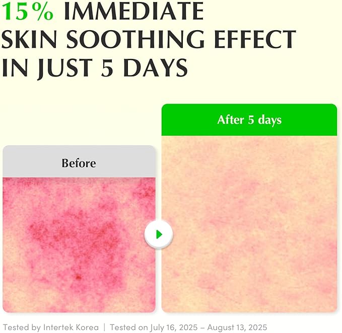 EQQUALBERRY Green Aid Aloe PDRN Calming Serum 30ml
