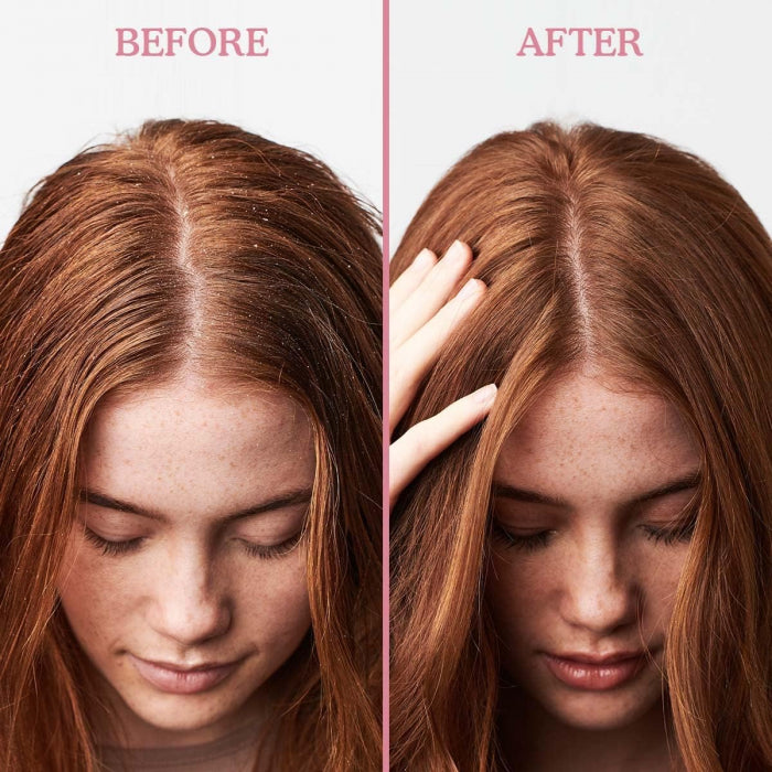 Umberto Giannini Scalp Restore Conditioner 250ml