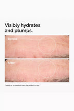 The Ordinary Hyaluronic Acid 2% and B5 30ml