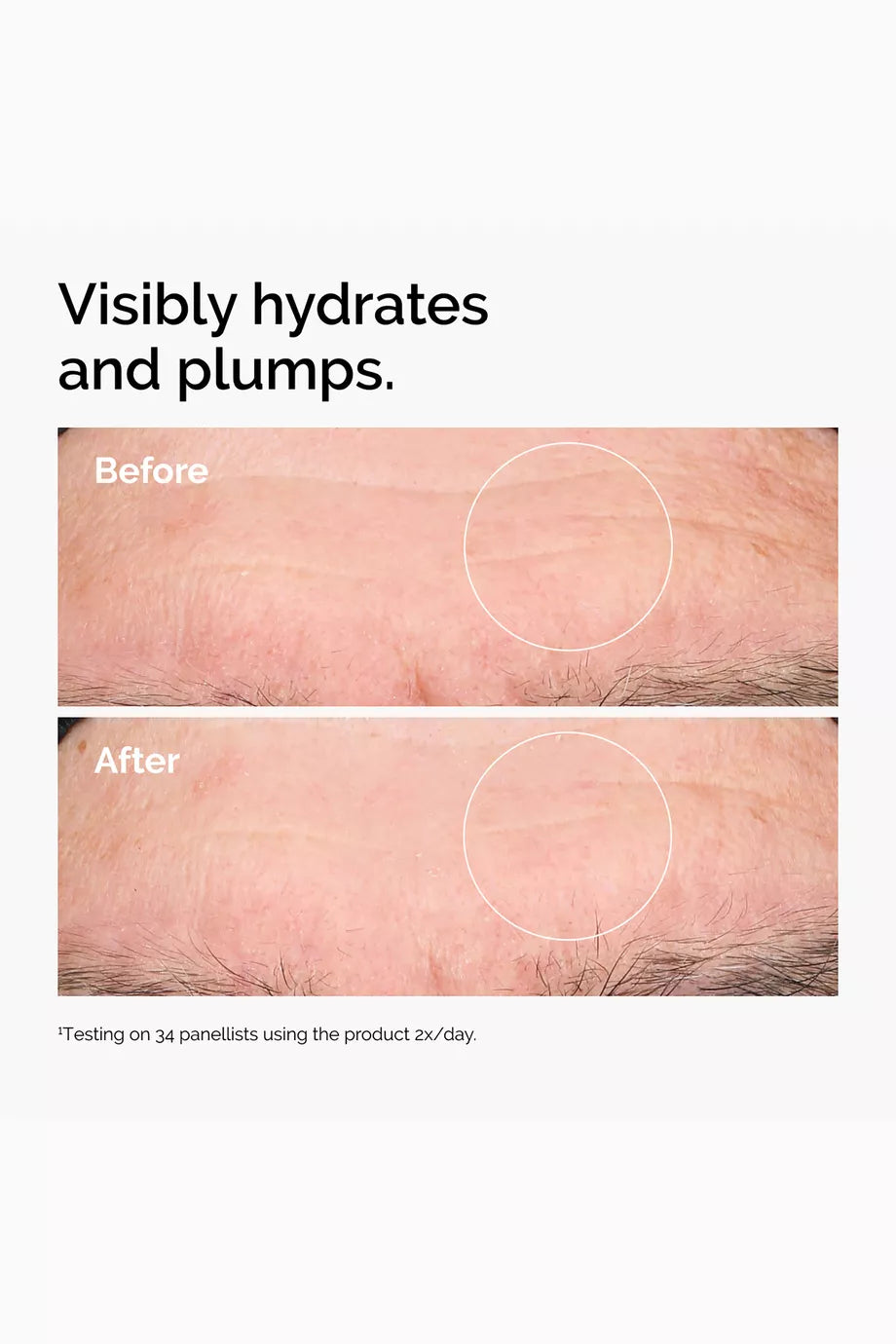 The Ordinary Hyaluronic Acid 2% and B5 30ml