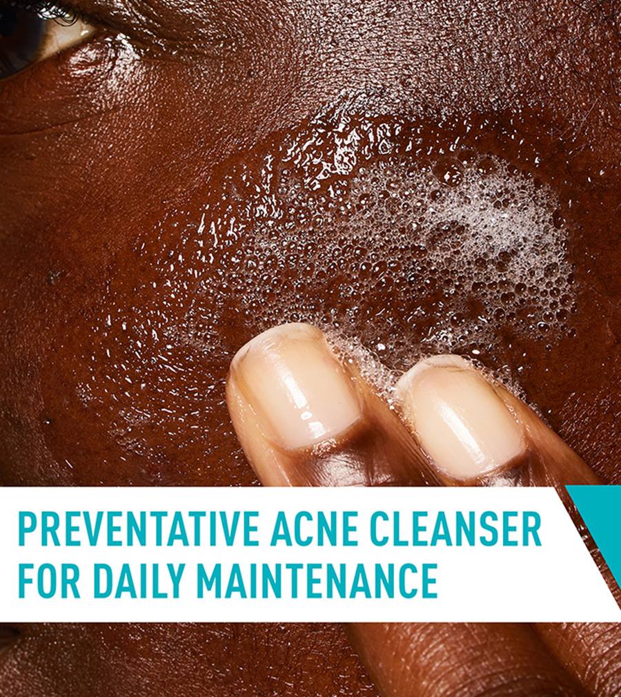 CeraVe Acne control cleanser 237ml.