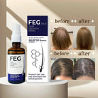 FEG plus hair growth spray 50ml