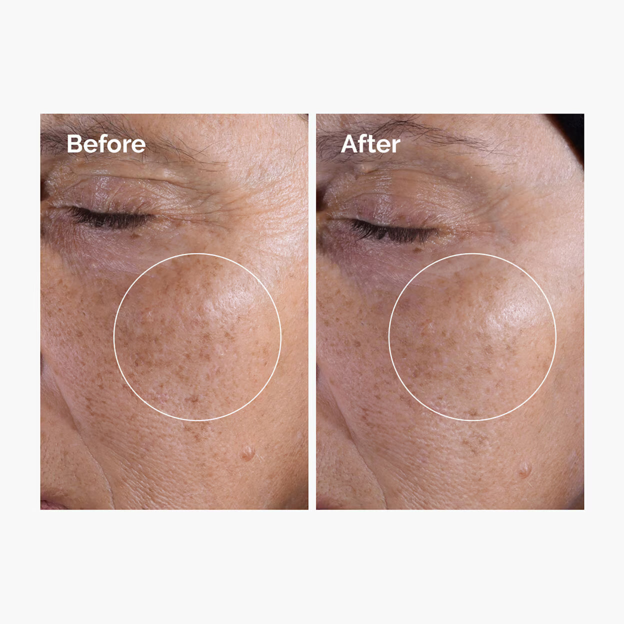 The Ordinary Glycolic Acid 7% Exfoliating Toner 240ml