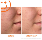 Kate Somerville Exfolikate Intensive Exfoliating Treatment - 60 ml