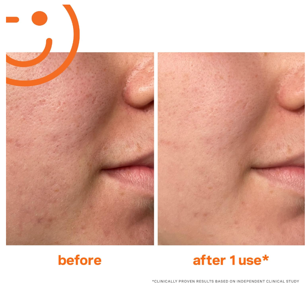Kate Somerville Exfolikate Intensive Exfoliating Treatment - 60 ml