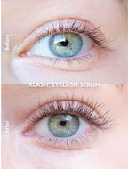 XLASH Eyelash Serum 1ML