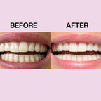 Gem Whitening Strips - 28 satchets