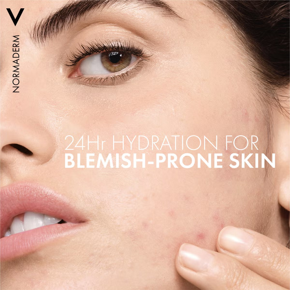 Vichy Normaderm Phytosolution Double Correction Daily Care Moisturiser 50ml