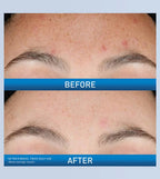 CeraVe Resurfacing Retinol Serum 30 ml