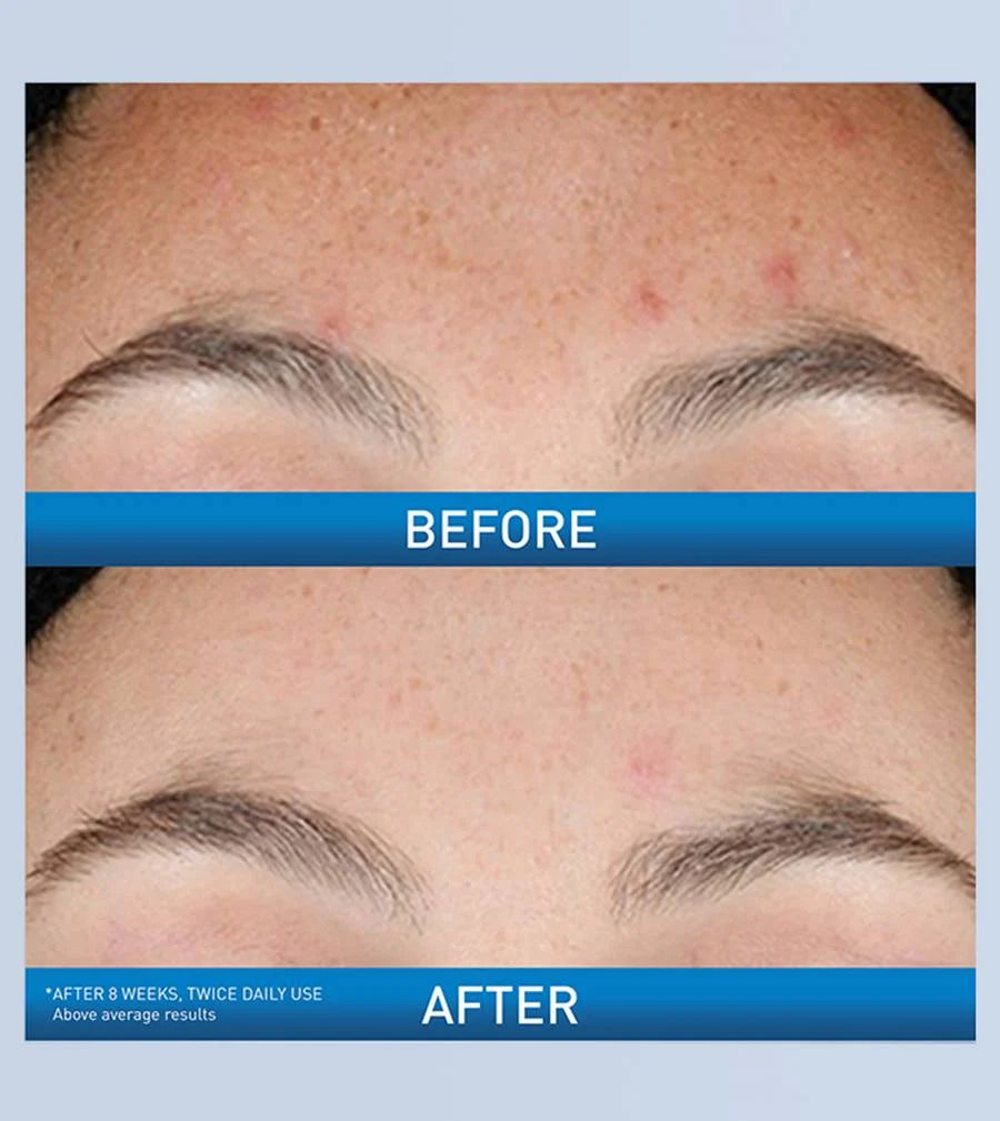 CeraVe Resurfacing Retinol Serum 30 ml